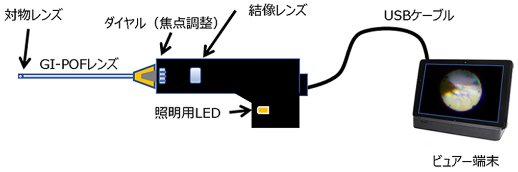 ニードルスコープの構造説明